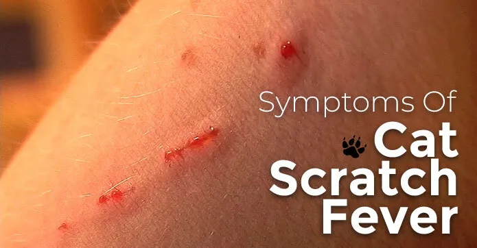 Cat Scratch Fever: Causes, Symptoms, And Treatment 1 Symptoms Of Cat Scratch Fever