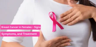 “Breast Cancer in Females – Signs, Symptoms, and Treatment”